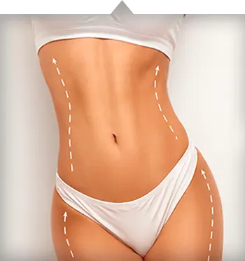 Cellulit i tkanka tłuszczowa